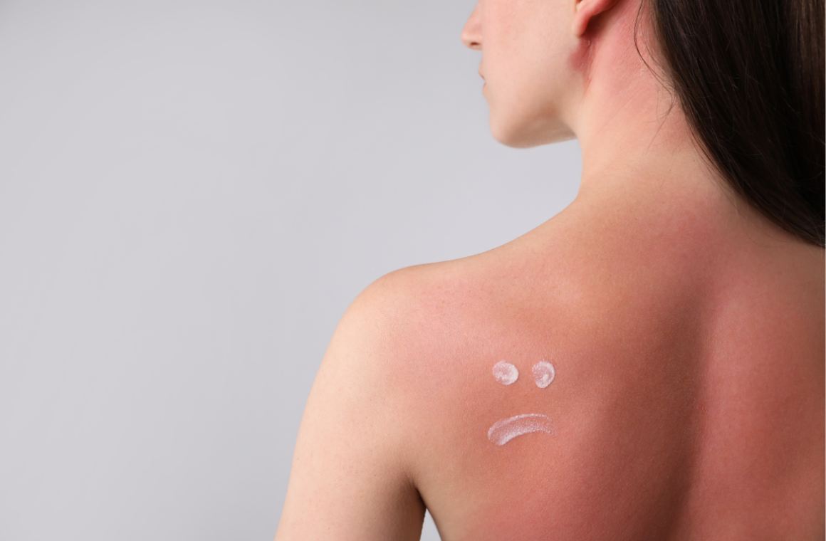 Sun-Damaged Skin